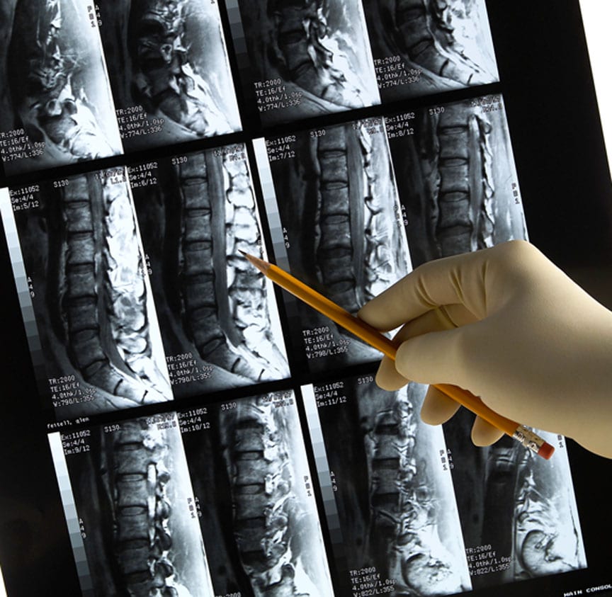 x-rays-after-personal-injury-Rafii-Law