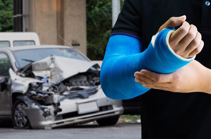 Close-up-of-man-with-a-blue-arm-cast-with-car-accident-in-the-background