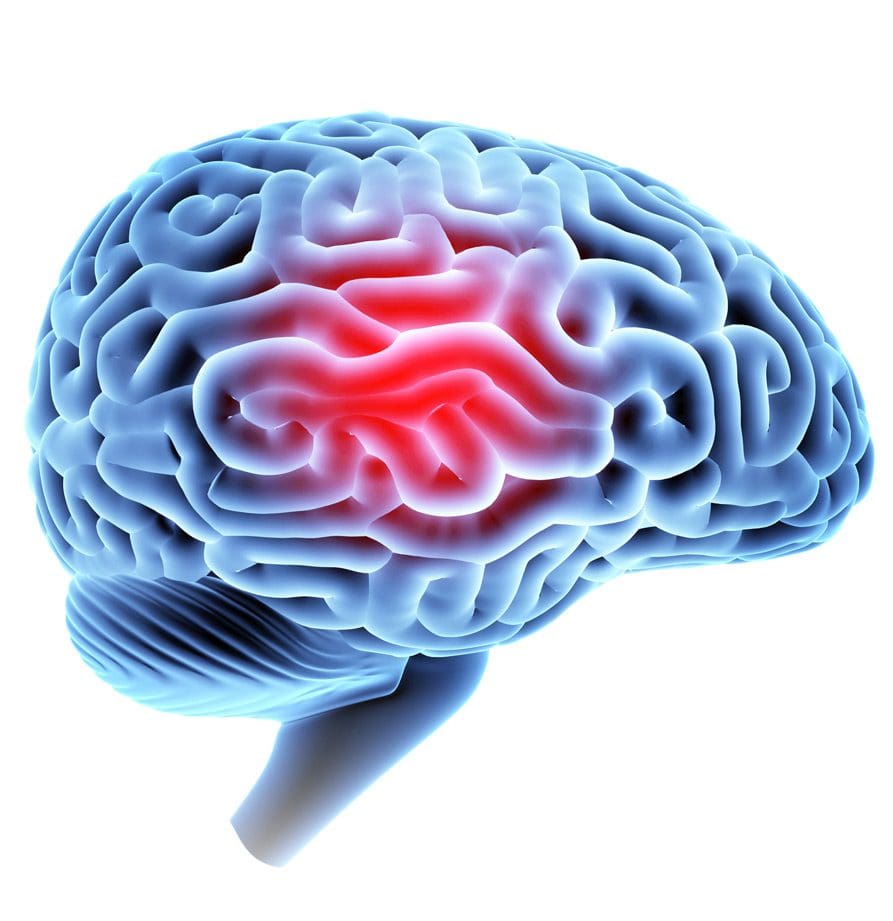 examining-head-injury-after-motorcycle-accident-Rafii-Law examining-head-injury-after-motorcycle-accident-Rafii-Law