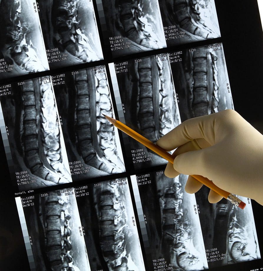 x-rays-after-personal-injury-Rafii-Law x-rays-after-personal-injury-Rafii-Law