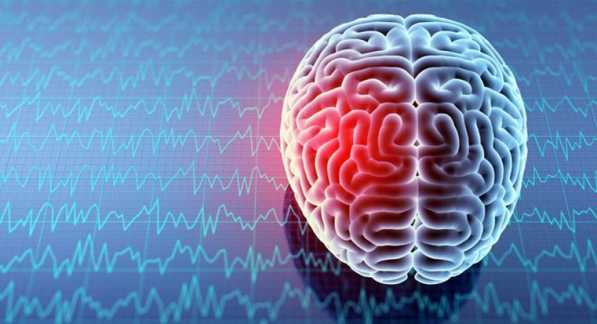Digital-illustration-of-brain-with-TBI